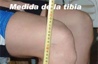 medida-de-la-tibia_imagen5