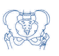 Lesiones deportivas. Pubalgia:la patología del concluyente inguino-pubiano